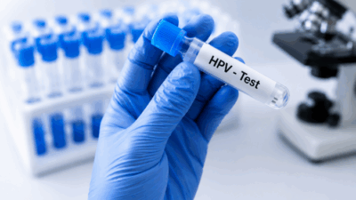 Nepal screening detects HPV in ninety women